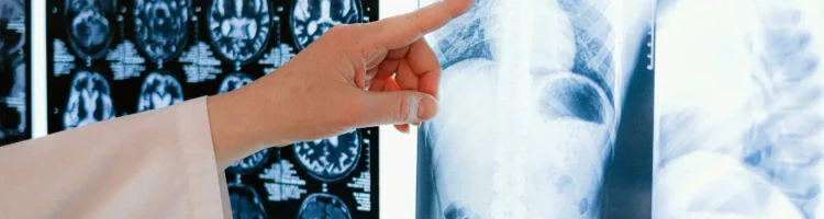 cancers en France